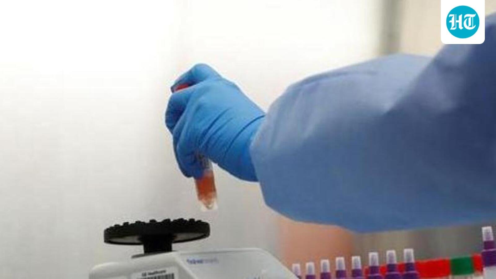 pmc-appoints-contractor-for-bsl-2-lab-&-metropolitan-surveillance-unit-at-kasba-peth